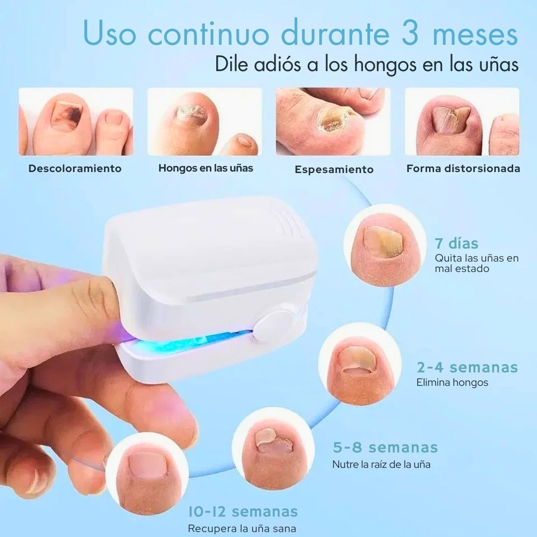 Láser para tratamiento de uñas - Hipnotelia