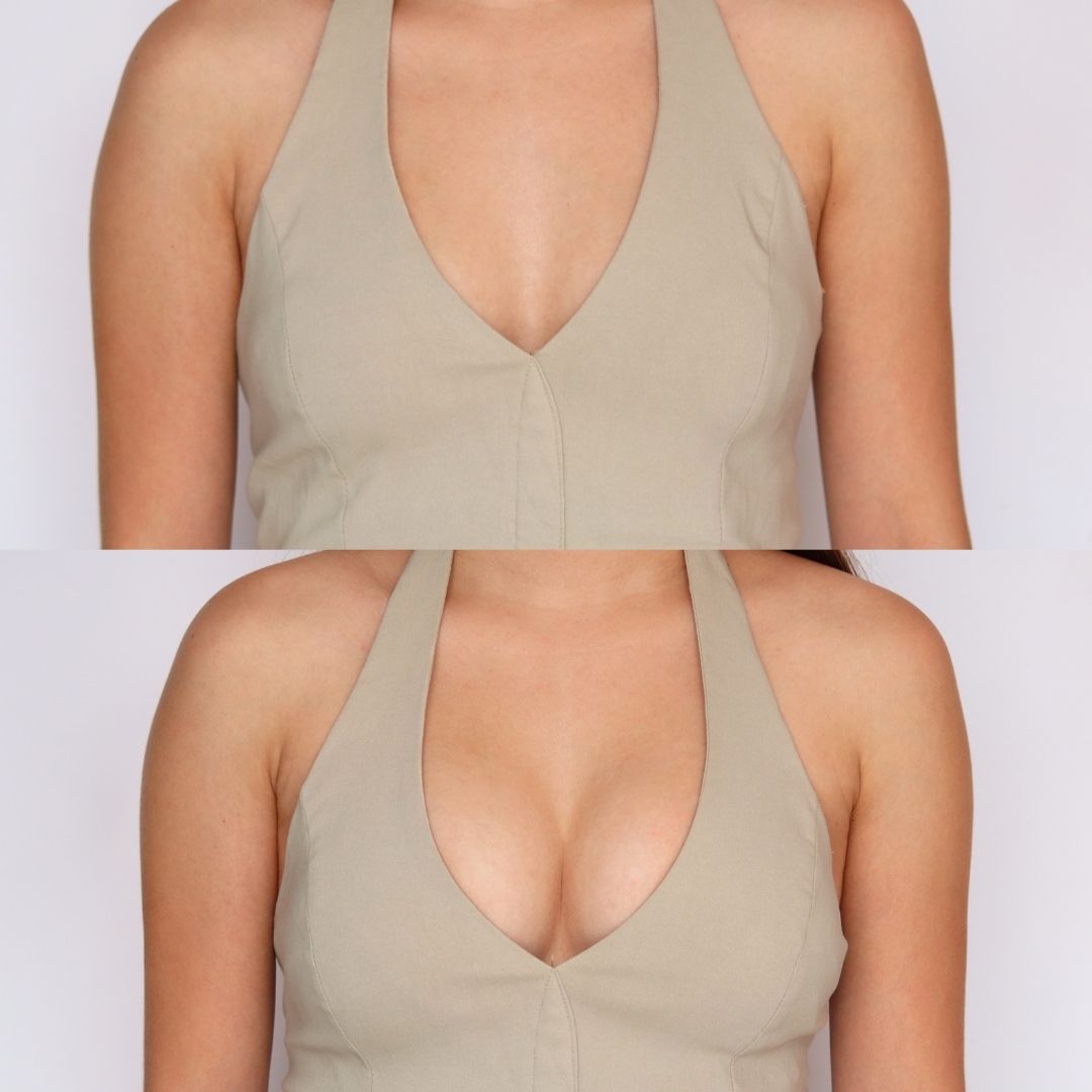 Almohadillas de relleno Push - Up Adhesivas - Hipnotelia