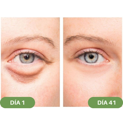 Gafas anti - ojeras de terapia lumínica - Hipnotelia