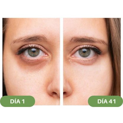 Gafas anti - ojeras de terapia lumínica - Hipnotelia