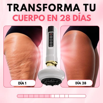 Masajeador Anticelulitis - Hipnotelia