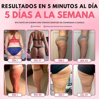 Masajeador Anticelulitis - Hipnotelia