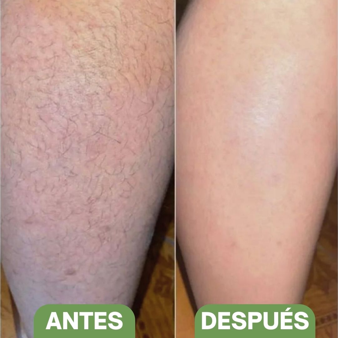 Piedra depiladora de cristal - Hipnotelia