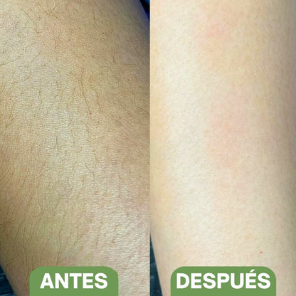 Piedra depiladora de cristal - Hipnotelia