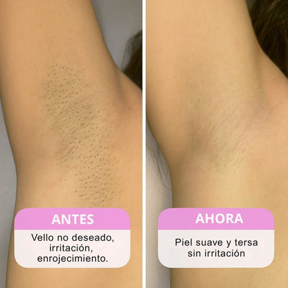 Rasuradora Eléctrica SilkGleam 2 en 1 - Hipnotelia