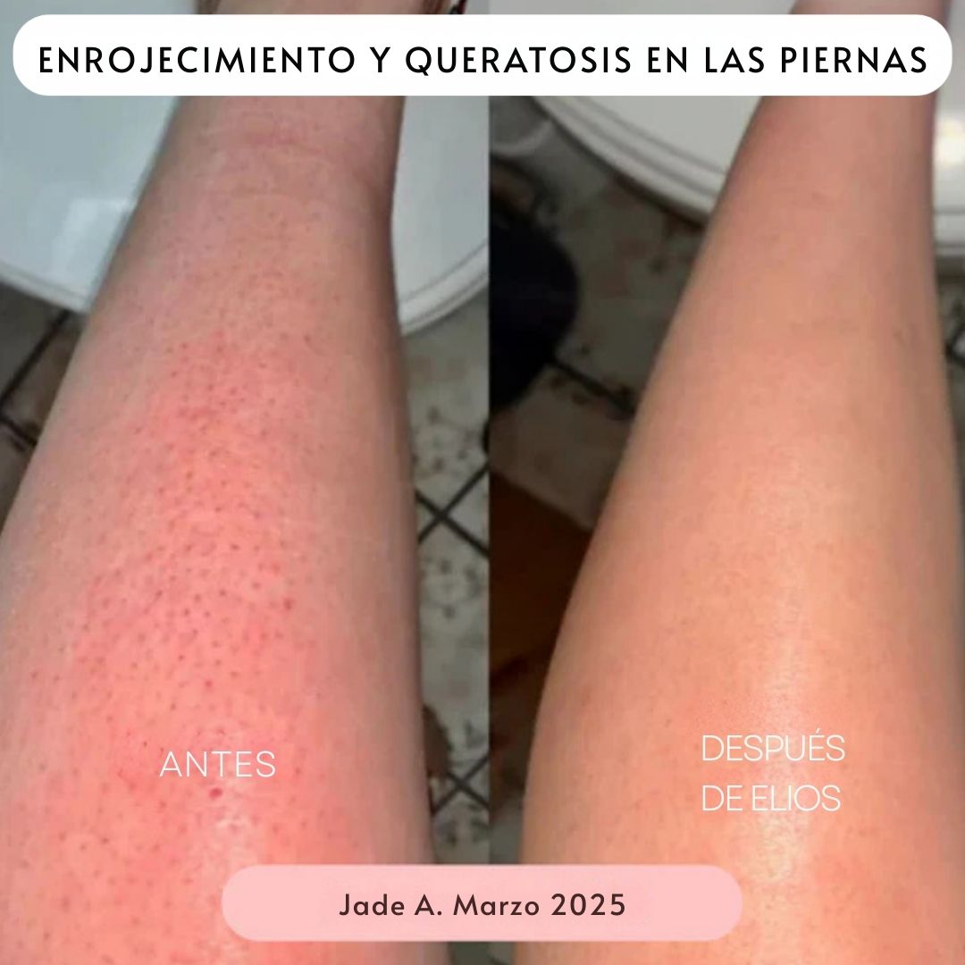 Rasuradora ELIOS 5 en 1 - Hipnotelia