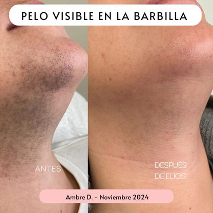 Rasuradora ELIOS 5 en 1 - Hipnotelia