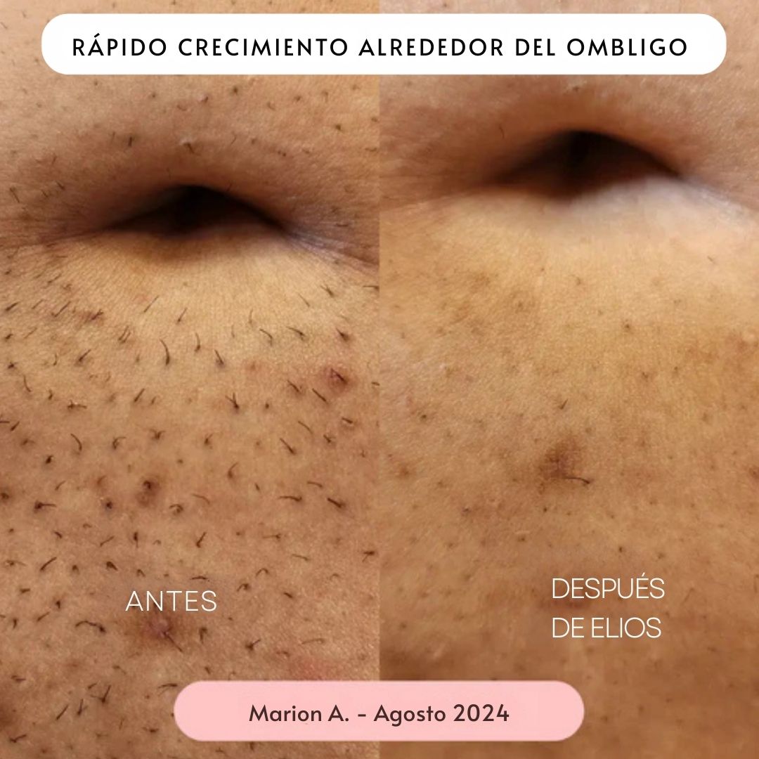 Rasuradora ELIOS 5 en 1 - Hipnotelia