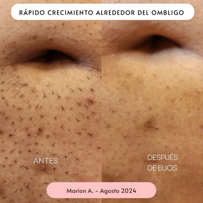 Rasuradora ELIOS 5 en 1 - Hipnotelia