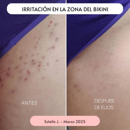 Rasuradora ELIOS 5 en 1 - Hipnotelia