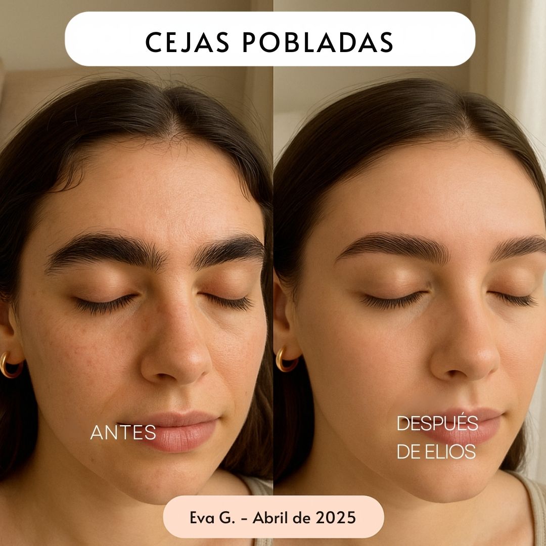 Rasuradora ELIOS 5 en 1 - Hipnotelia