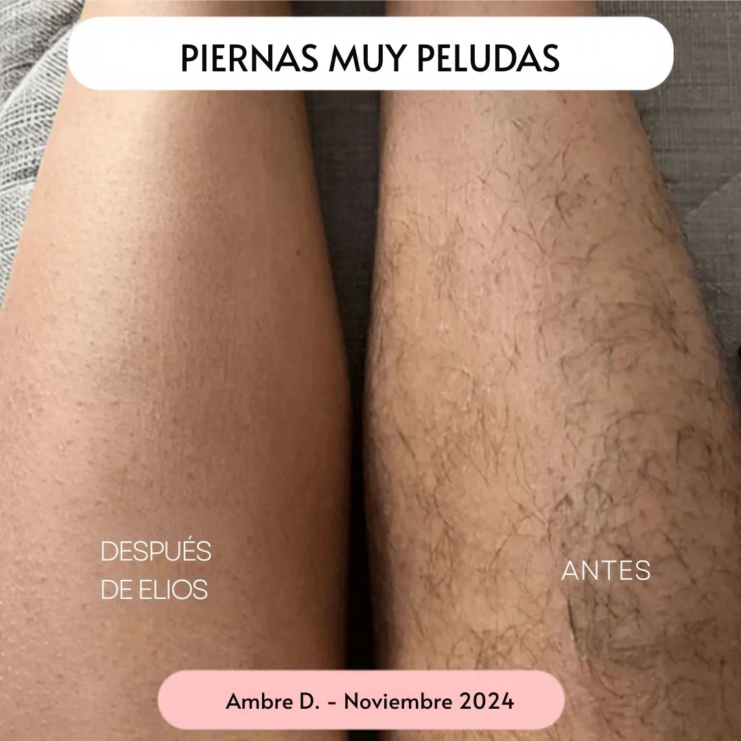 Rasuradora ELIOS 5 en 1 - Hipnotelia