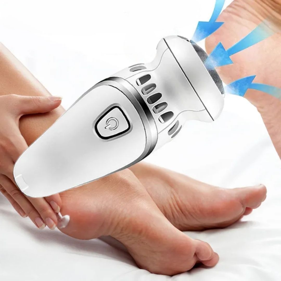 Removedor de callos eléctrico recargable - Hipnotelia