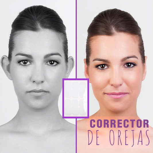 CORRECTOR DE OREJAS ERO EAR